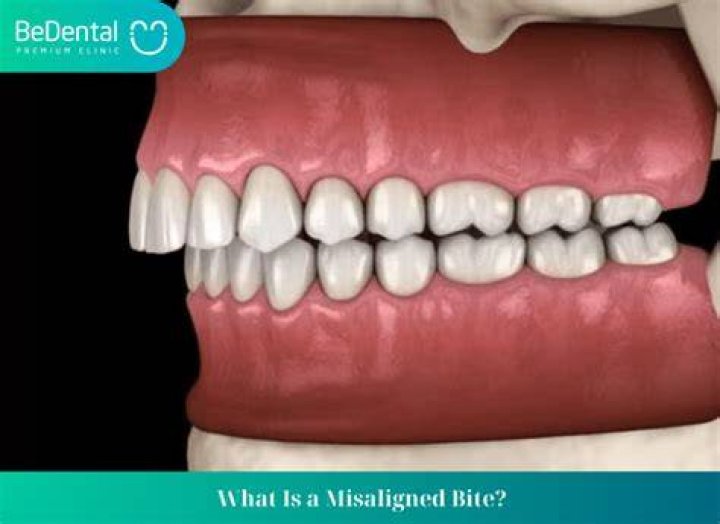 Can a misaligned bite be fixed?