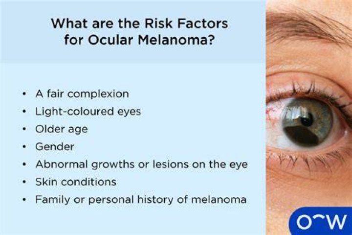 Can an optometrist diagnose ocular melanoma?