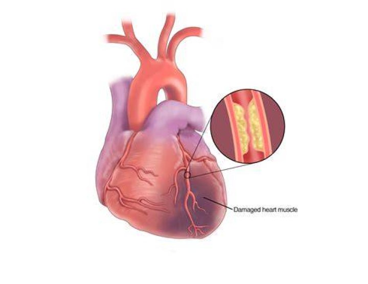 Can CBD damage your heart?