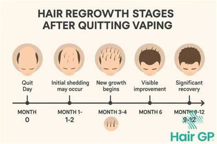 Can quitting vaping cause hair loss?