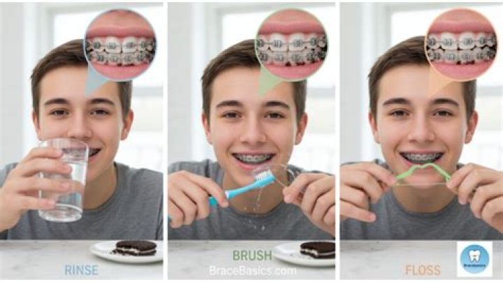 Can u eat Oreos with braces?