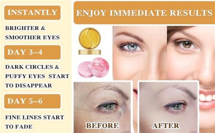 Can you put collagen under eyes?