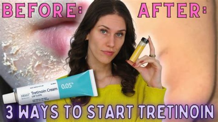 Can you put tretinoin on top of hyaluronic acid?