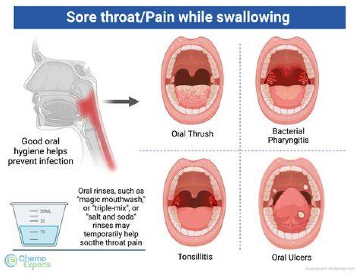 Do you get sore throat with thyroid?