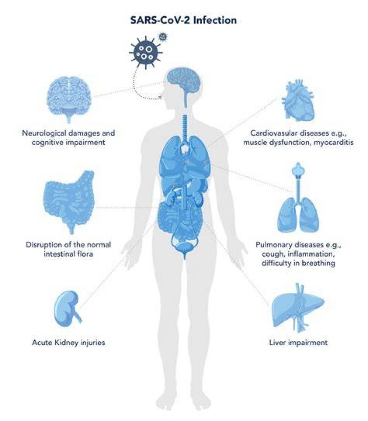 Does Covid affect arthritis?