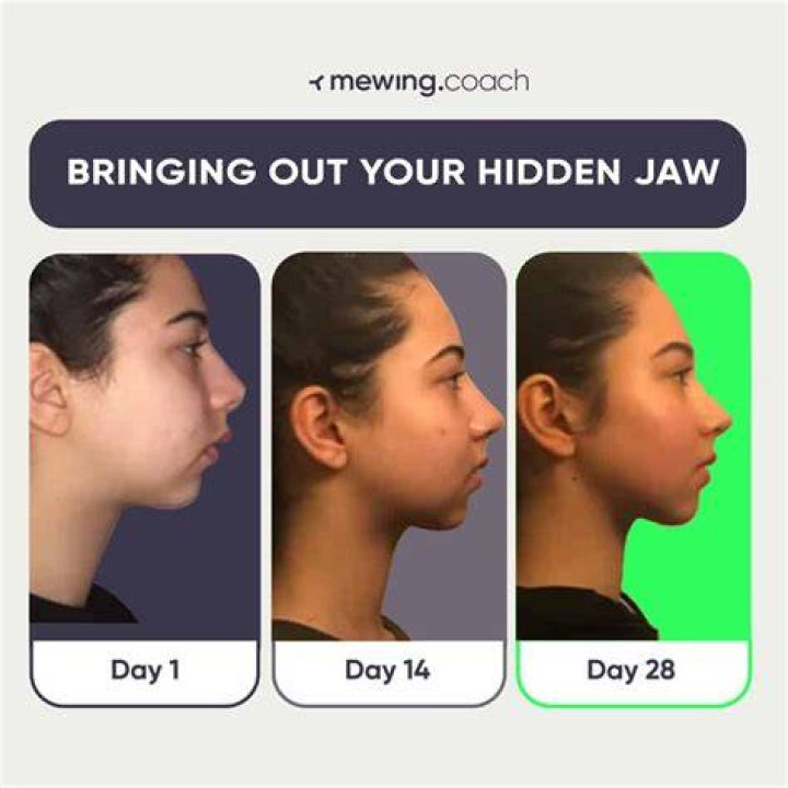 How can I change my jawline?
