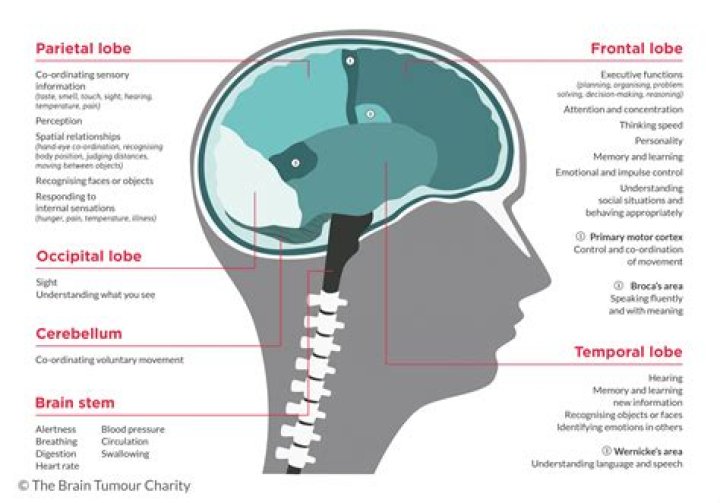 How do brain tumors affect your eyes?