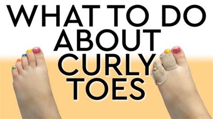 How do you fix a curly pinky toe?