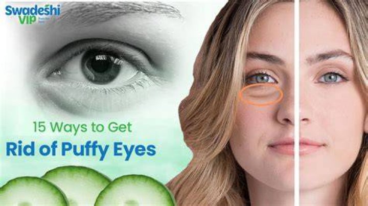 How do you get rid of puffy eyes after drinking?