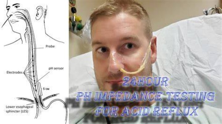 How do you test for GERD?