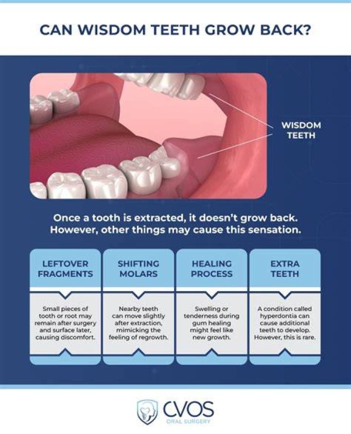 How long can you keep wisdom teeth?
