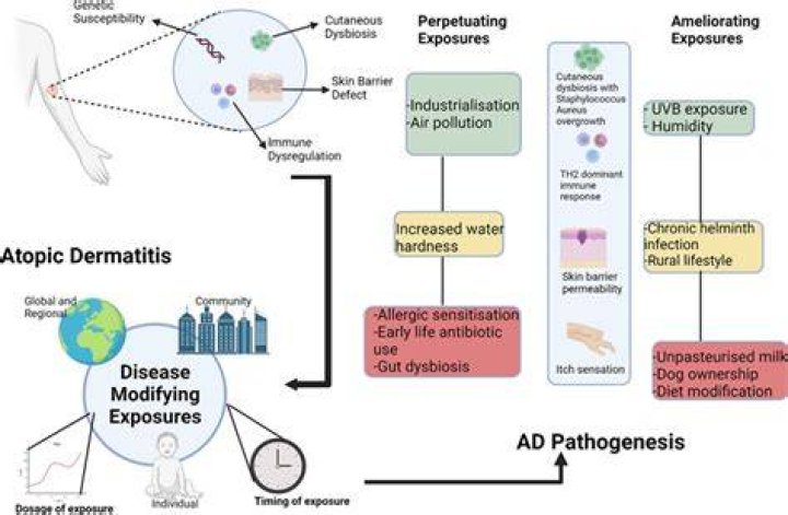 Is eczema genetic or environmental?