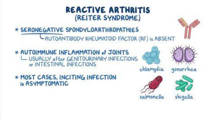 Is reactive arthritis the same as rheumatoid arthritis?
