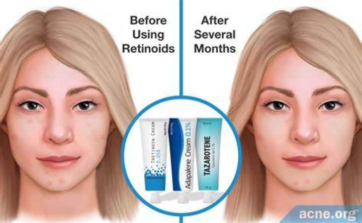 Is retinol the same as collagen?