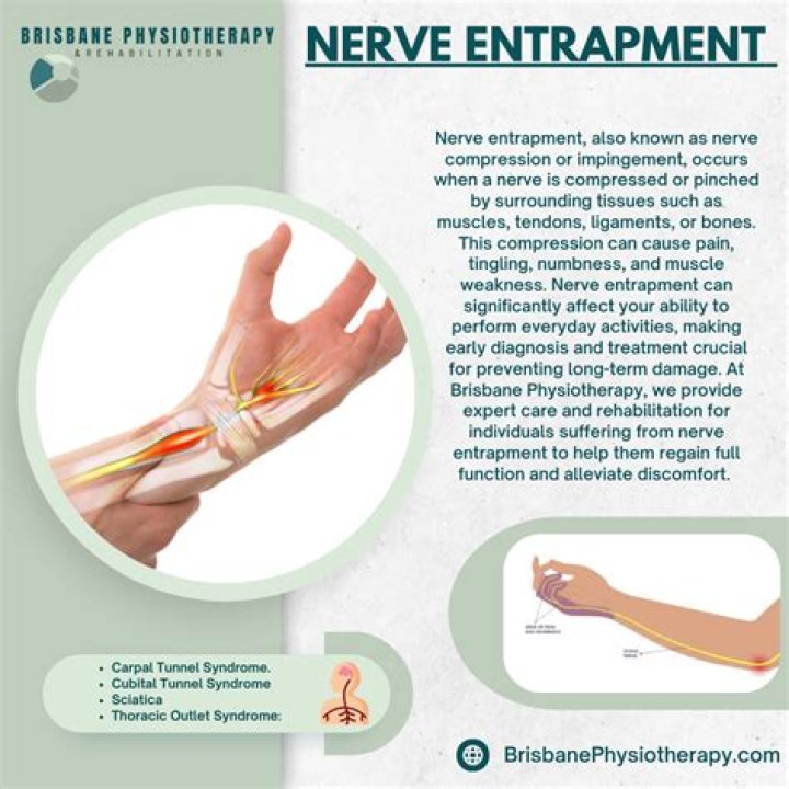 What are entrapment neuropathies?