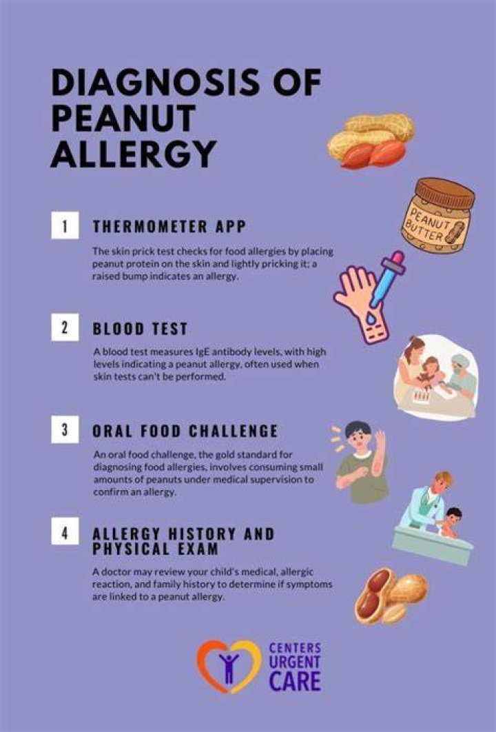What are peanut allergy symptoms?