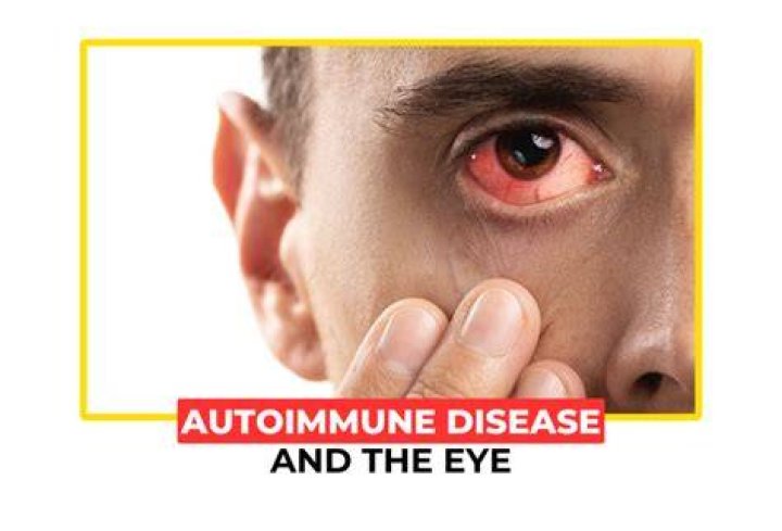 What autoimmune conditions affect the eyes?