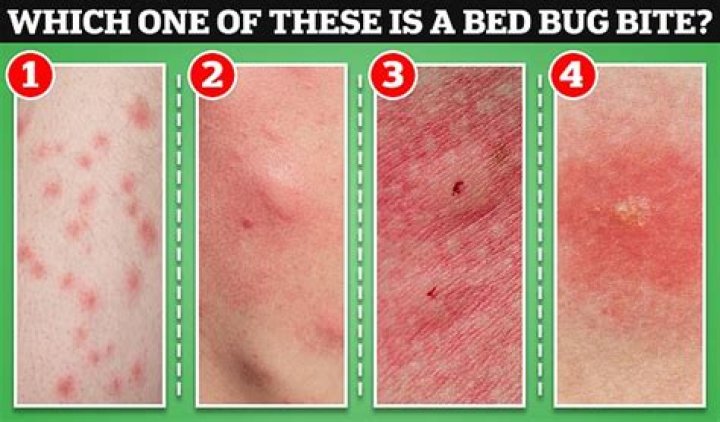 What bugs bite at night in bed?
