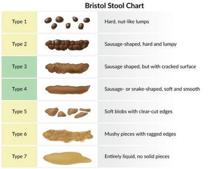 What dissolves impacted stool?