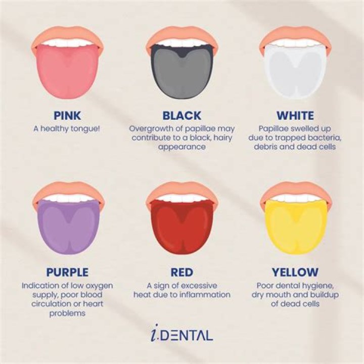 What does it mean when a dentist says you have pockets?