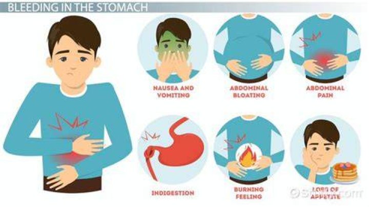 What does stomach bleeding feel like?