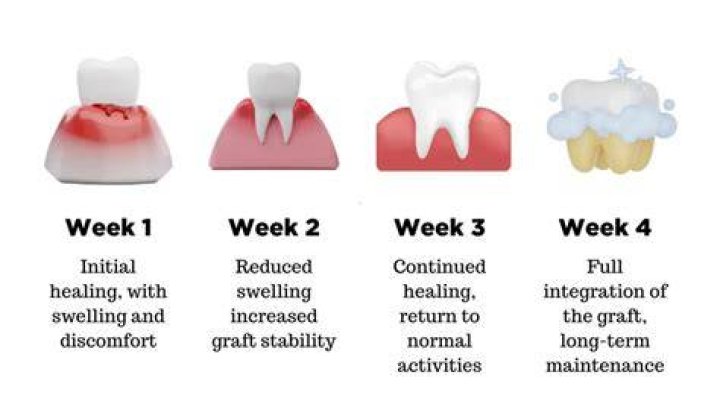 What helps gums heal after surgery?
