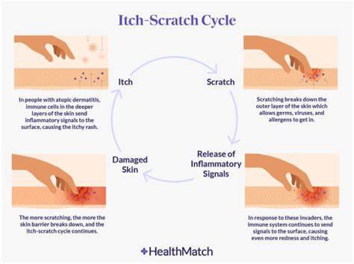 What is an itch caused by?