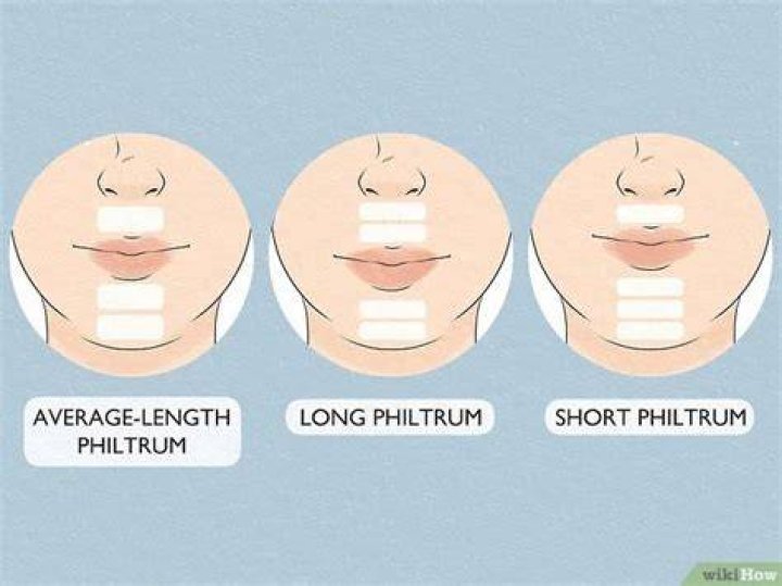 What is considered a long philtrum?