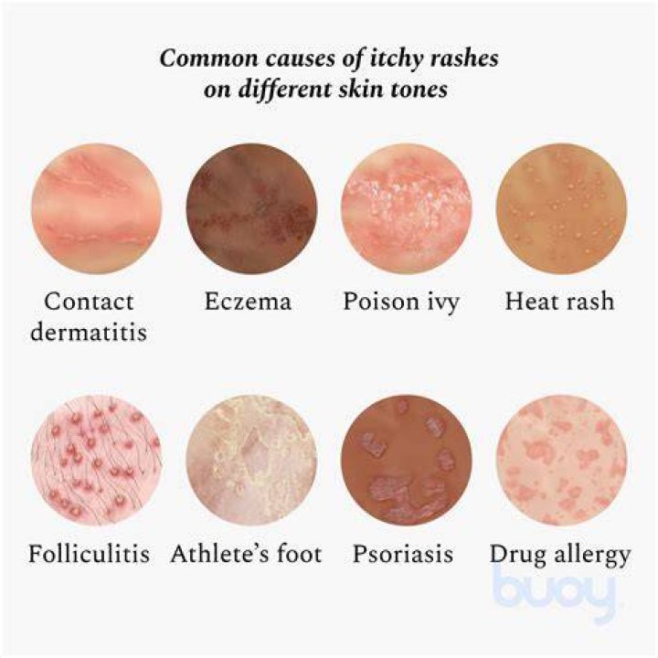 What is the cause of an itchy body?