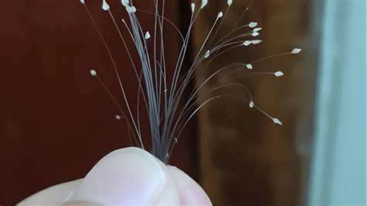What is the white stuff on my dreadlocks?