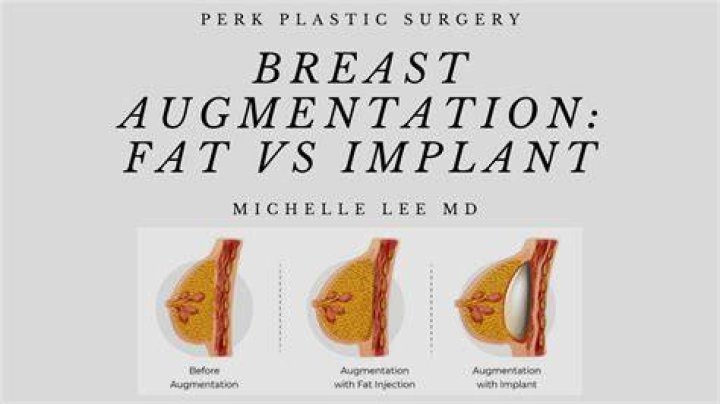 What should I not eat before breast augmentation?