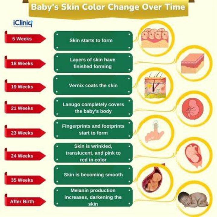 Which parent determines the skin color of baby?