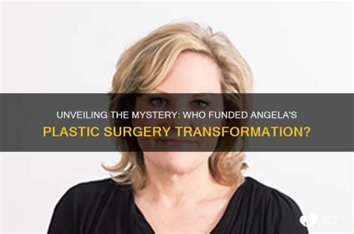 Who paid for Angela's plastic surgery?