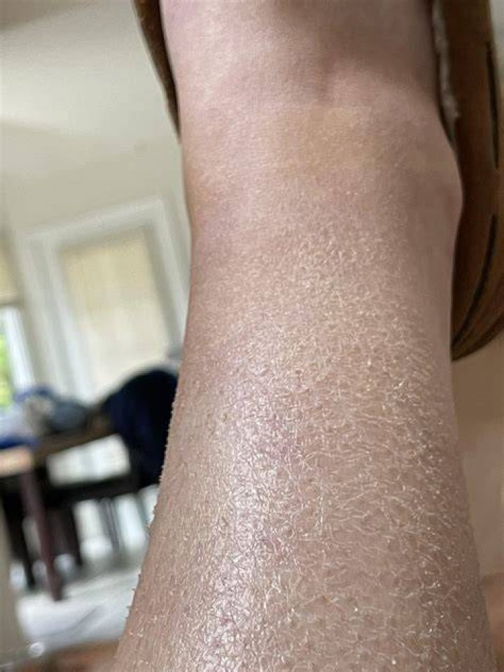 Why are my legs shiny after swimming?