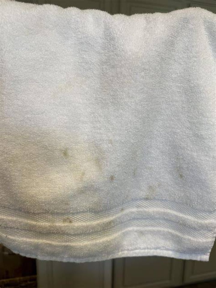 Why are my white towels getting brown spots?