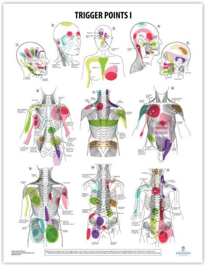 Why do I have so many trigger points?