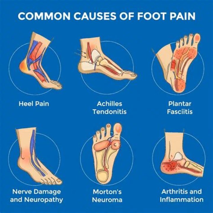 Why do my feet hurt after resting?