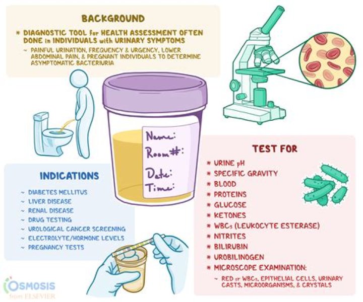 Will a urine test show kidney disease?