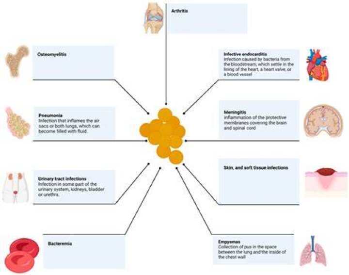 Will antibiotics help face swelling?